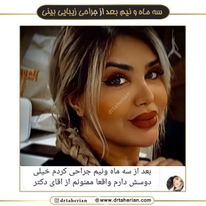 جراحی-بینی-582