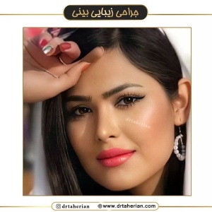 جراحی-بینی-585