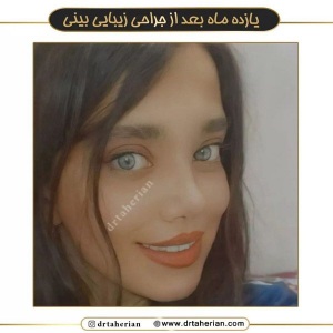 جراحی-بینی-589