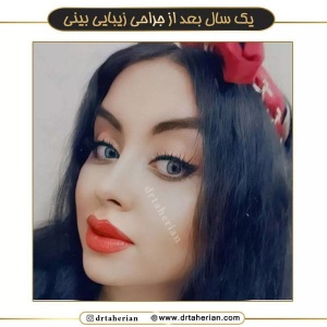 جراحی-بینی-590