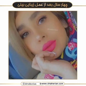 جراحی-بینی-595