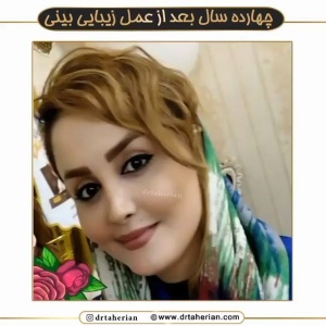 جراحی-بینی-597