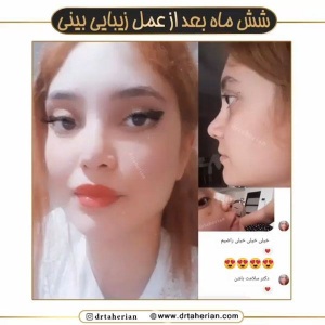 جراحی-بینی-600