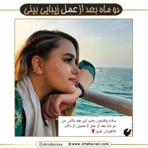 جراحی-بینی-601