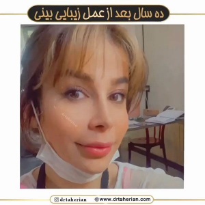 جراحی-بینی-602
