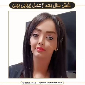 جراحی-بینی-606
