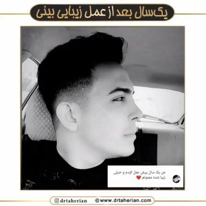 جراحی-بینی-608