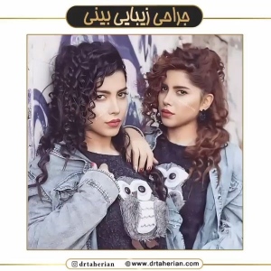 جراحی-بینی-610