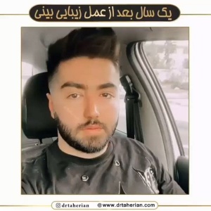جراحی-بینی-612