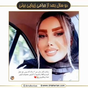 جراحی-بینی-617
