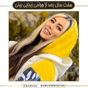 جراحی-بینی-618