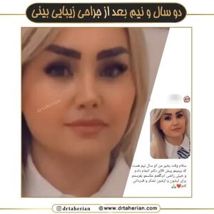 جراحی-بینی-619