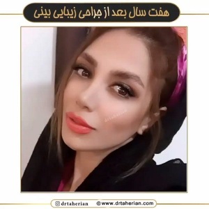 جراحی-بینی-620
