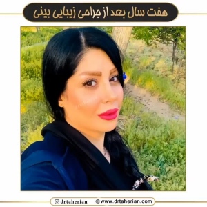 جراحی-بینی-621