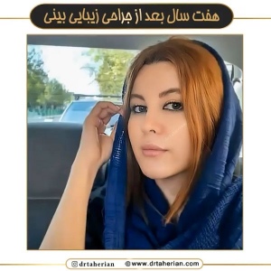 جراحی-بینی-622