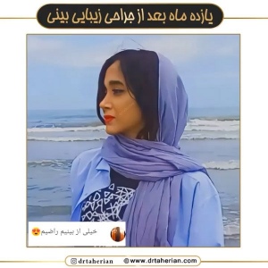 جراحی-بینی-623