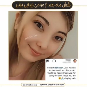 جراحی-بینی-628