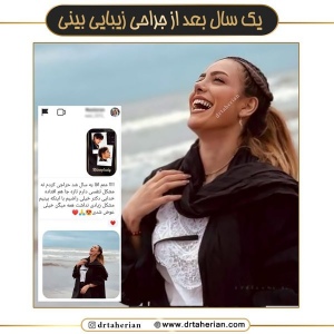 جراحی-بینی-634
