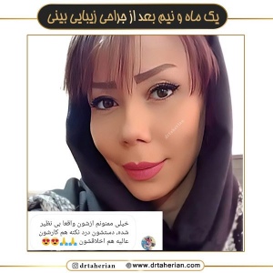 جراحی-بینی-635