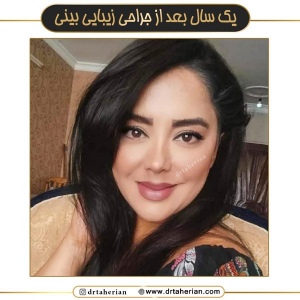 جراحی-بینی-637