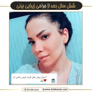 جراحی-بینی-641