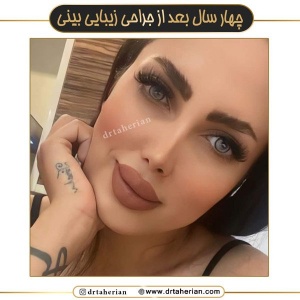 جراحی-بینی-642