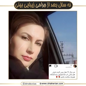 جراحی-بینی-644