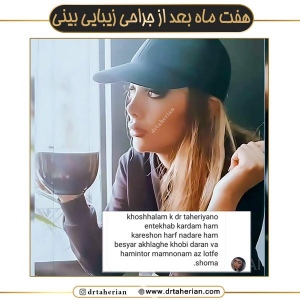 جراحی-بینی-645