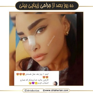 جراحی-بینی-646