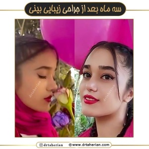 جراحی-بینی-647