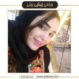 جراحی-بینی-650