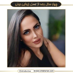 جراحی-بینی-651