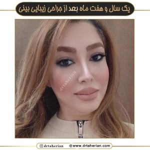 جراحی-بینی-656