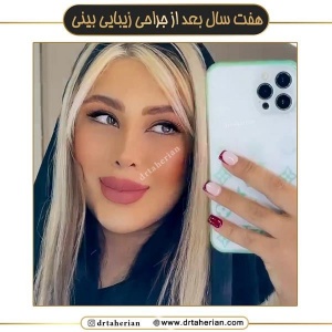 جراحی-بینی-659