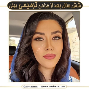 جراحی-بینی-662