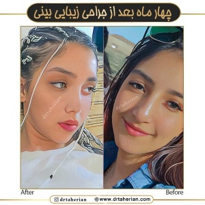 جراحی-بینی-663