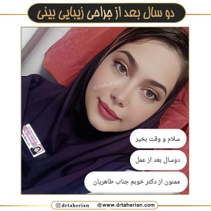 جراحی-بینی-664