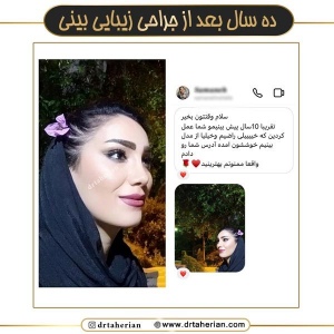 جراحی-بینی-665