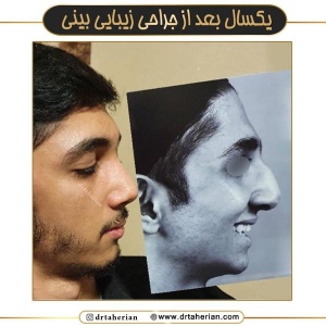 جراحی-بینی-669