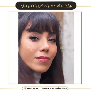 جراحی-بینی-671