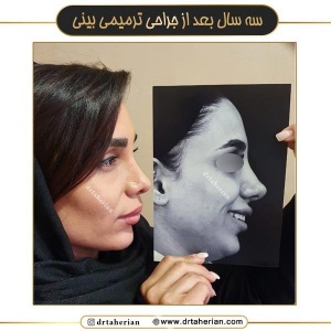 جراحی-بینی-672