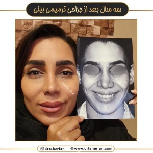 جراحی-بینی-673