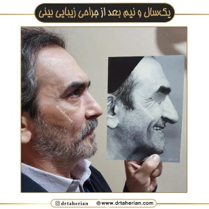 جراحی-بینی-676