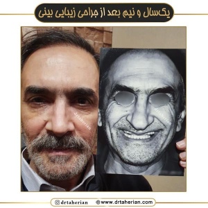 جراحی-بینی-677