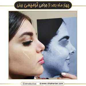جراحی-بینی-678