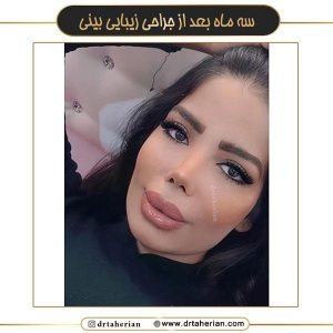 جراحی-بینی-679