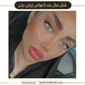 جراحی-بینی-705