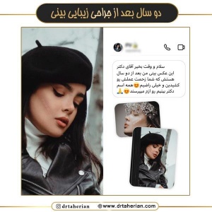 جراحی-بینی-708