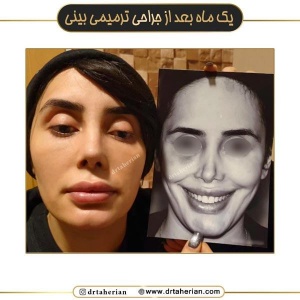 جراحی-بینی-713