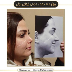 جراحی-بینی-716